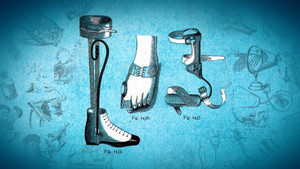 Orthopedics