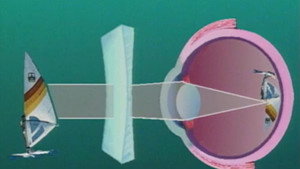 The Eye