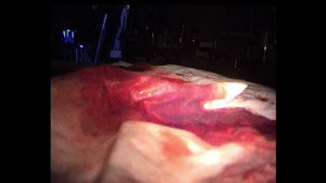 Épisode 9